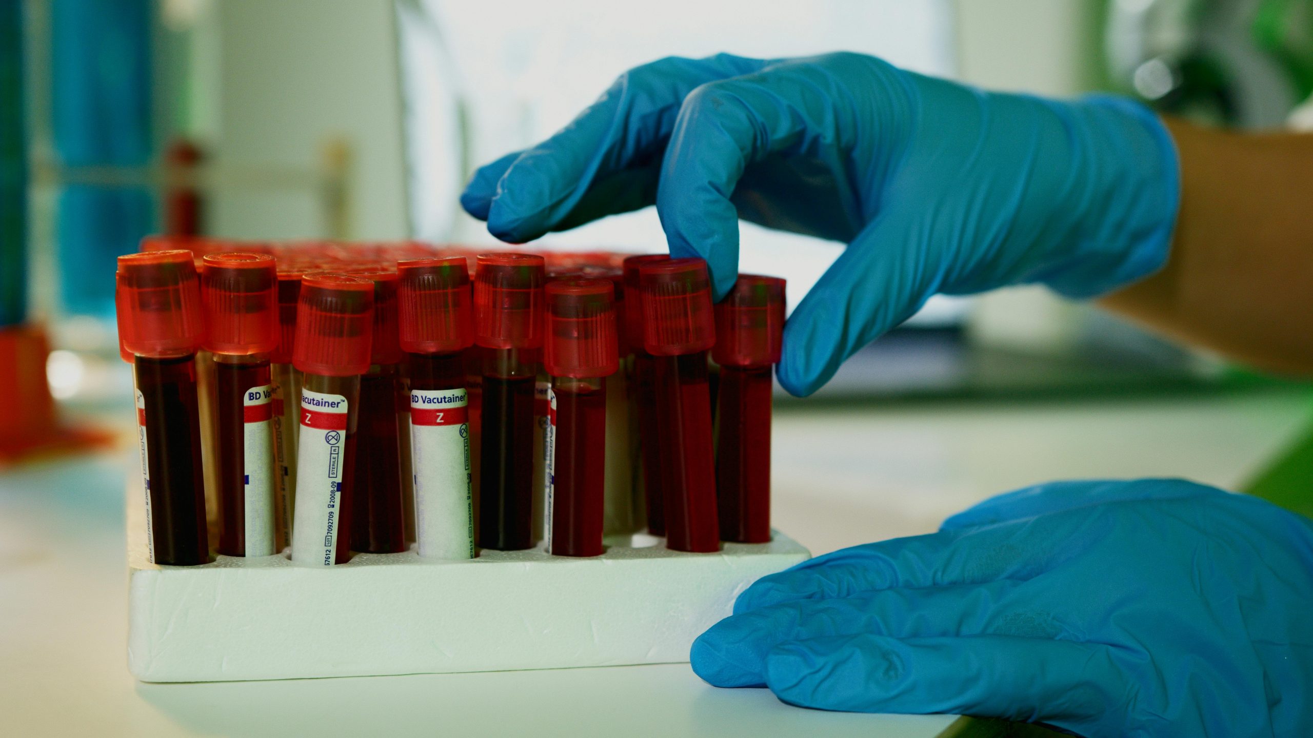 A Diferença entre Influenza, COVID-19 e Resfriado Comum: O Papel dos Exames Laboratoriais