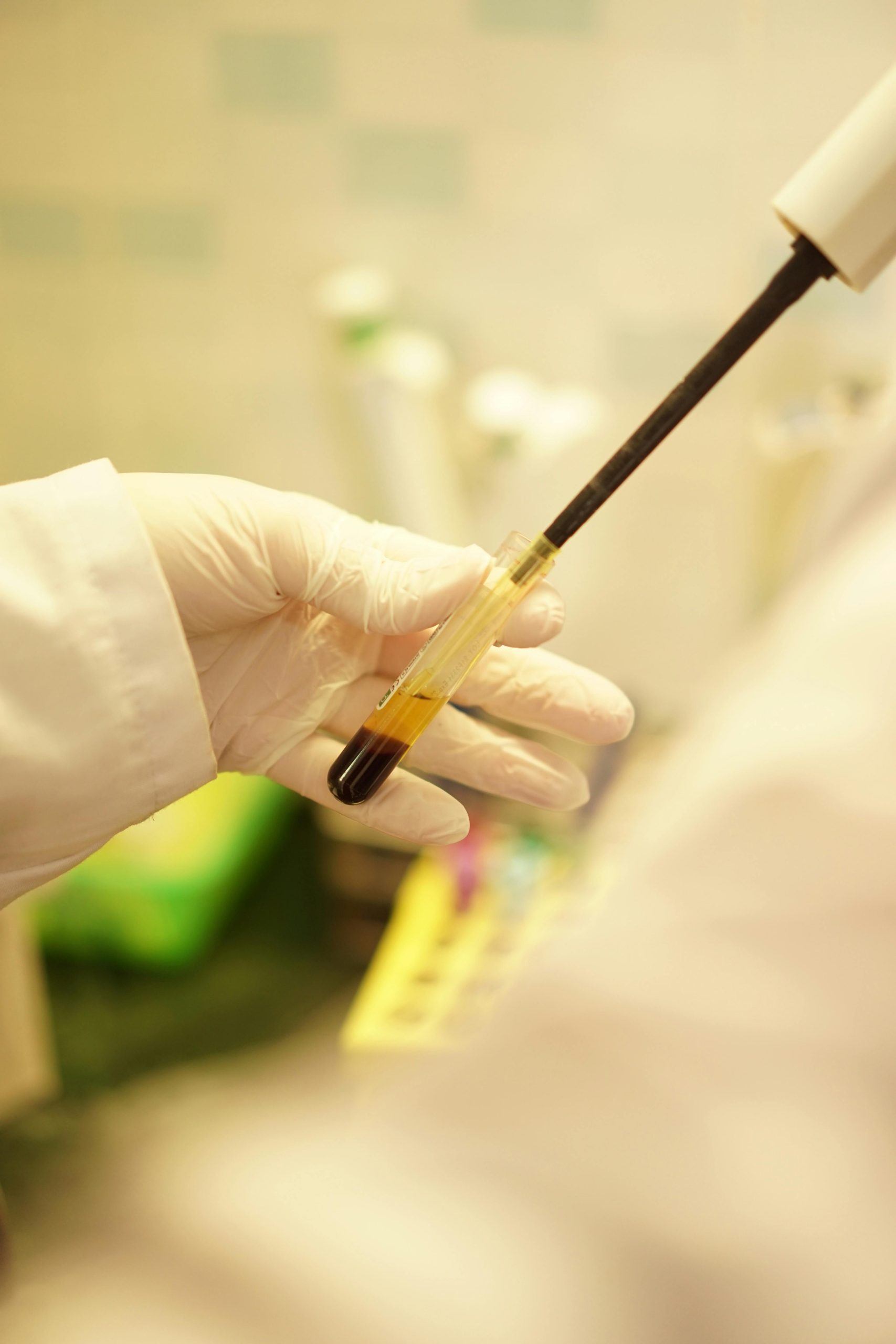 Como os Exames Laboratoriais Podem Prevenir Surtos de Influenza em 2025