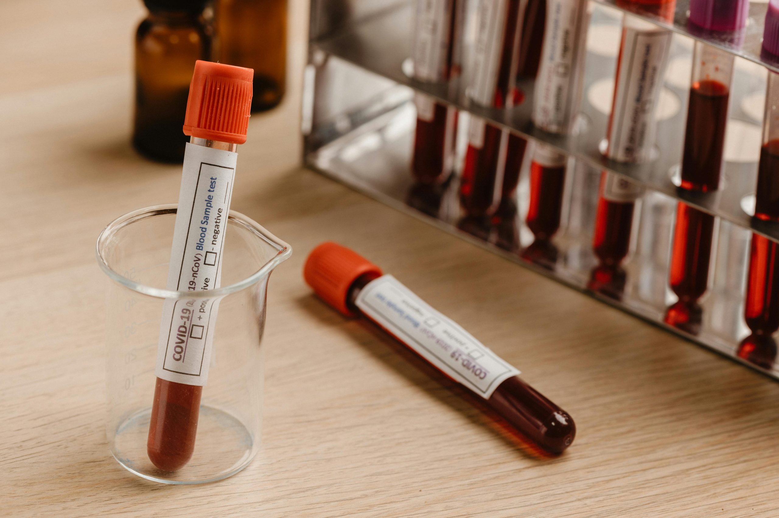 A Importância de Continuar Realizando Testes de COVID-19 em 2025