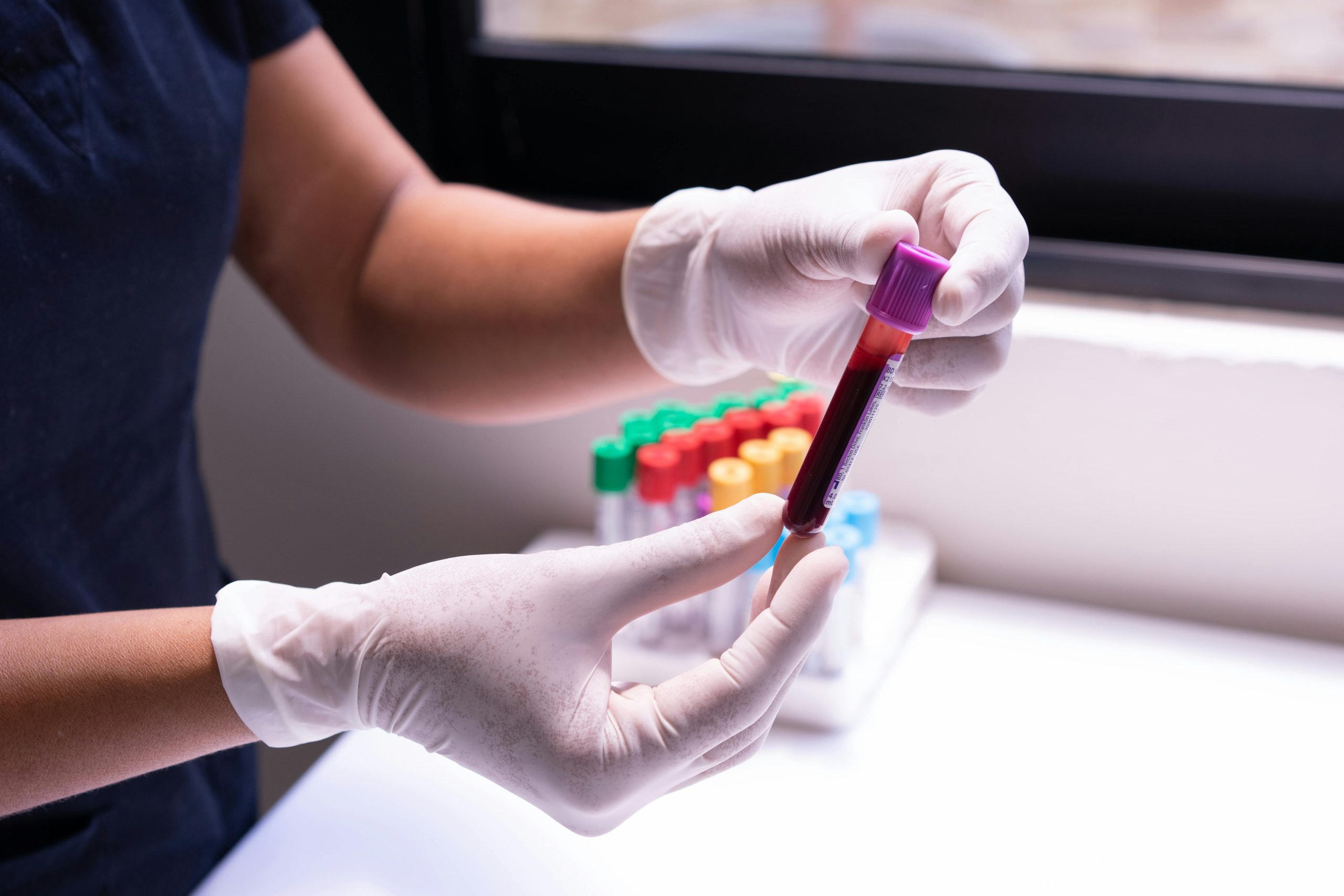 O check-up de saúde e seu impacto nas doenças silenciosas