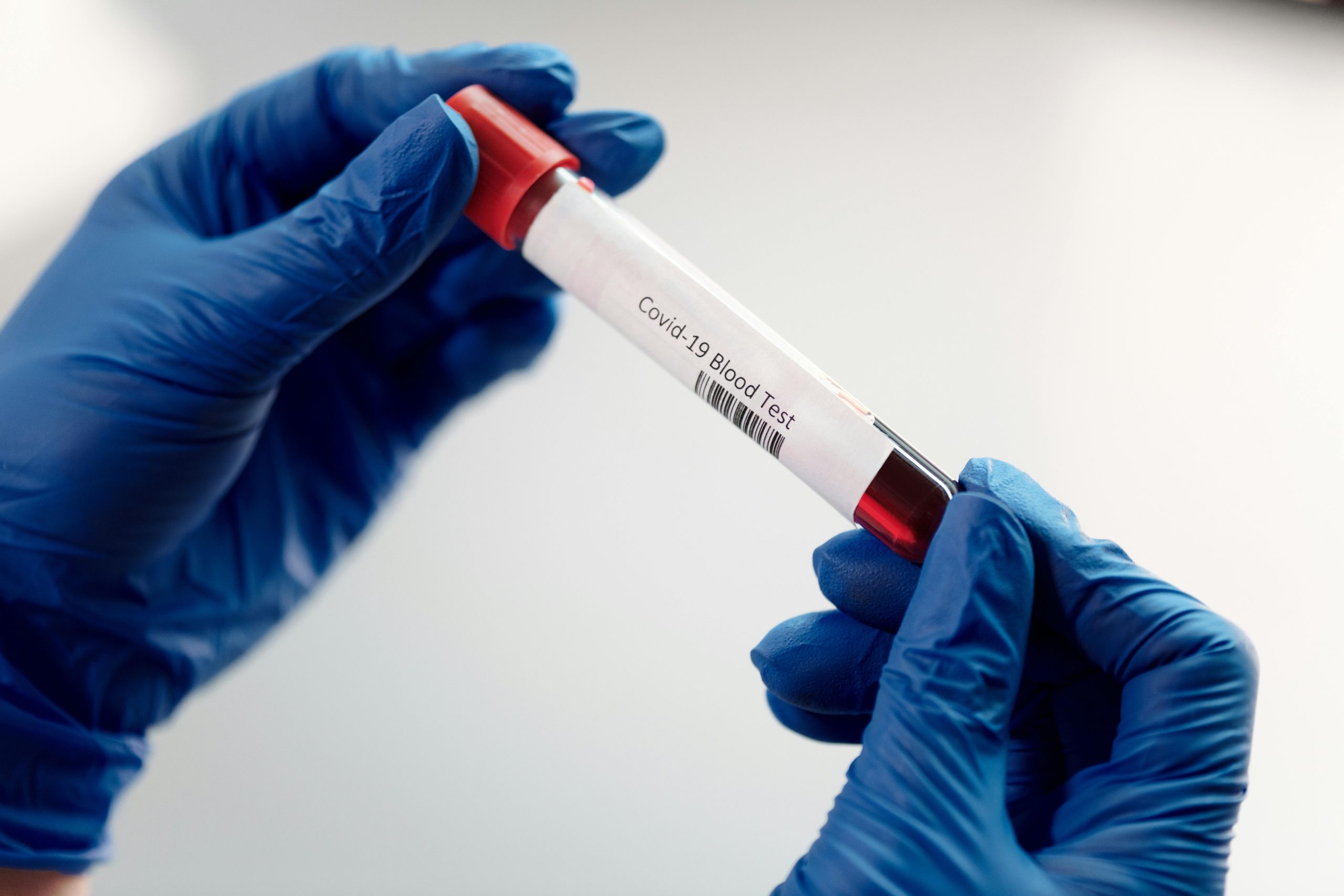 Prevenção é o Melhor Remédio: A Importância do Check-up de Início de Ano