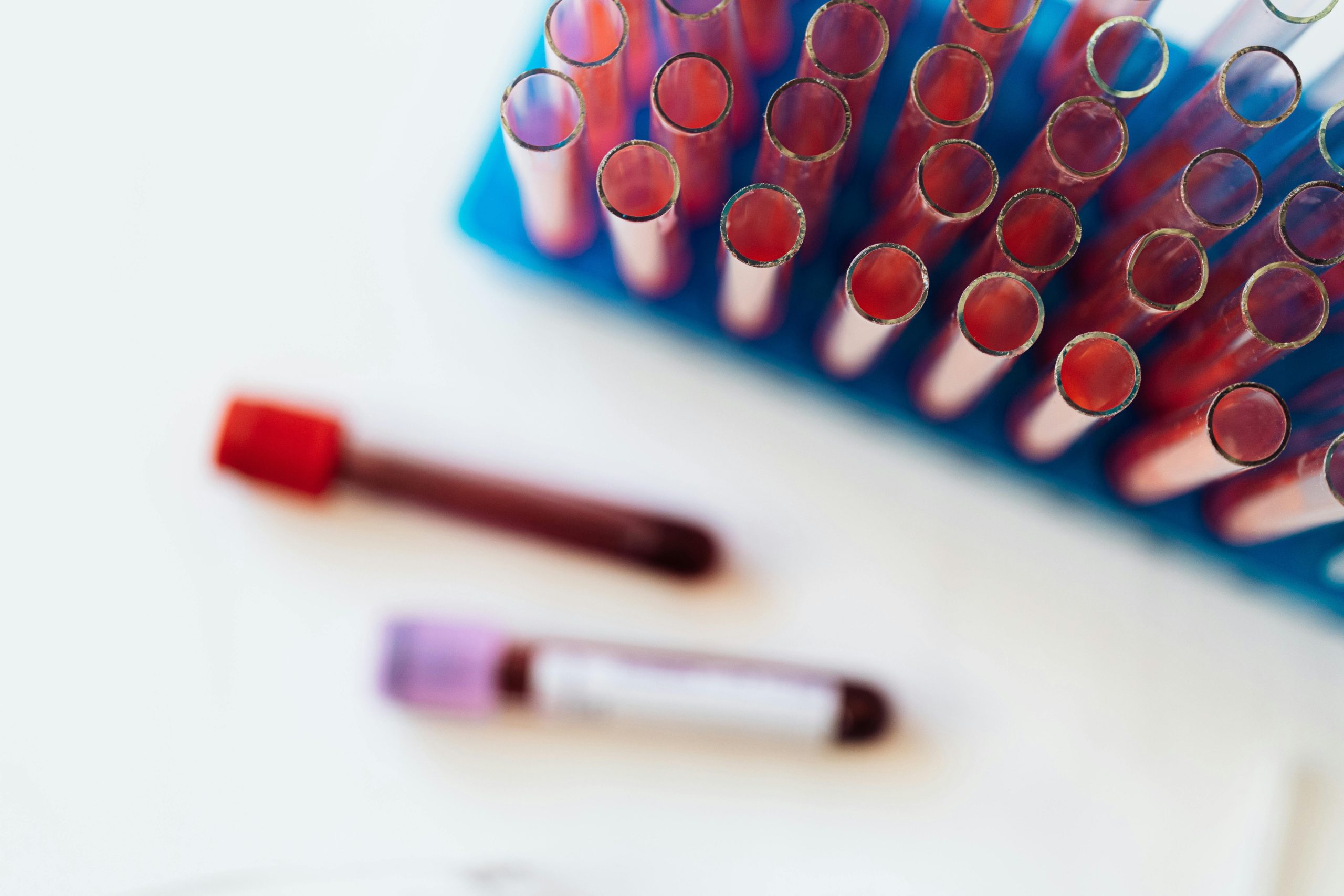 A Importância de Monitorar Sua Saúde com Exames Laboratoriais Durante Surtos de Dengue, COVID-19 e Influenza