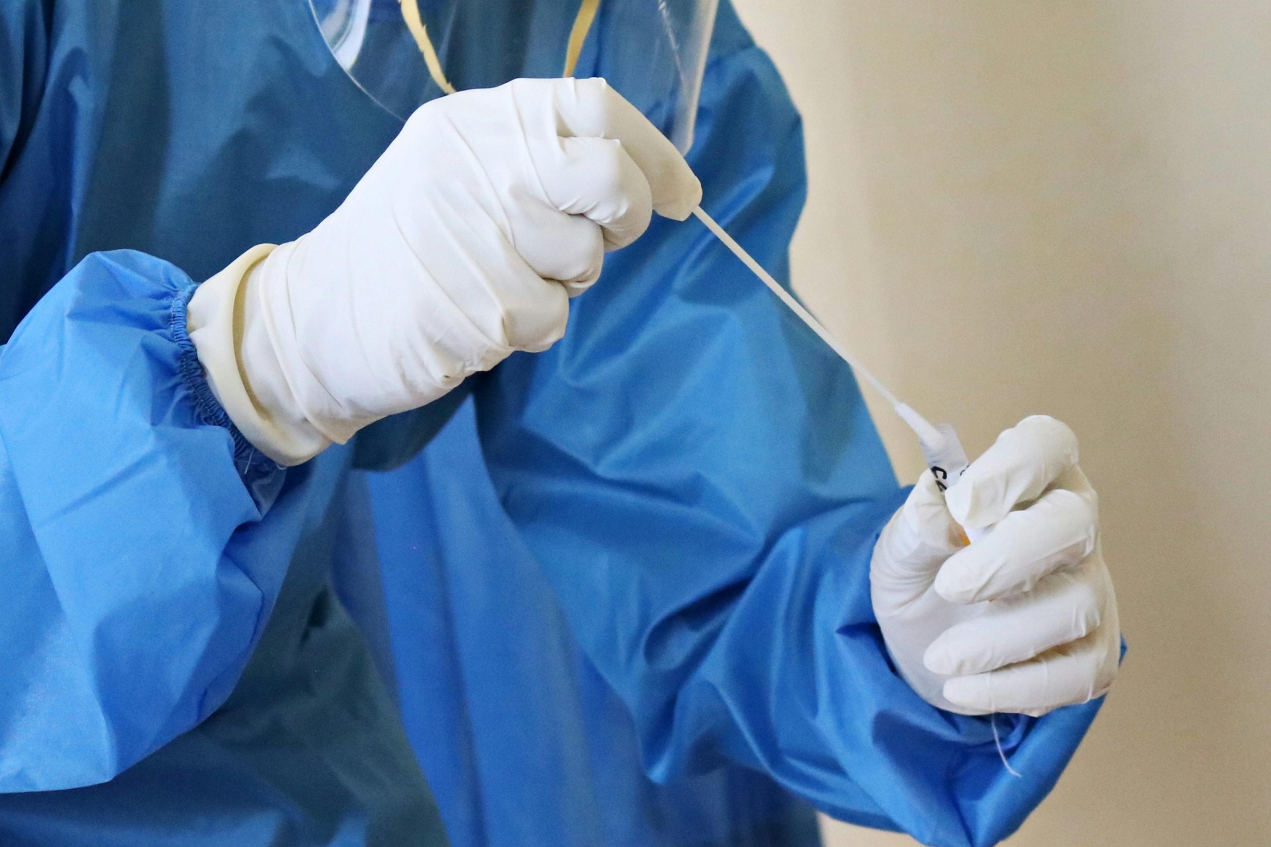 Como os Testes de COVID-19 São Essenciais no Controle da Pandemia?