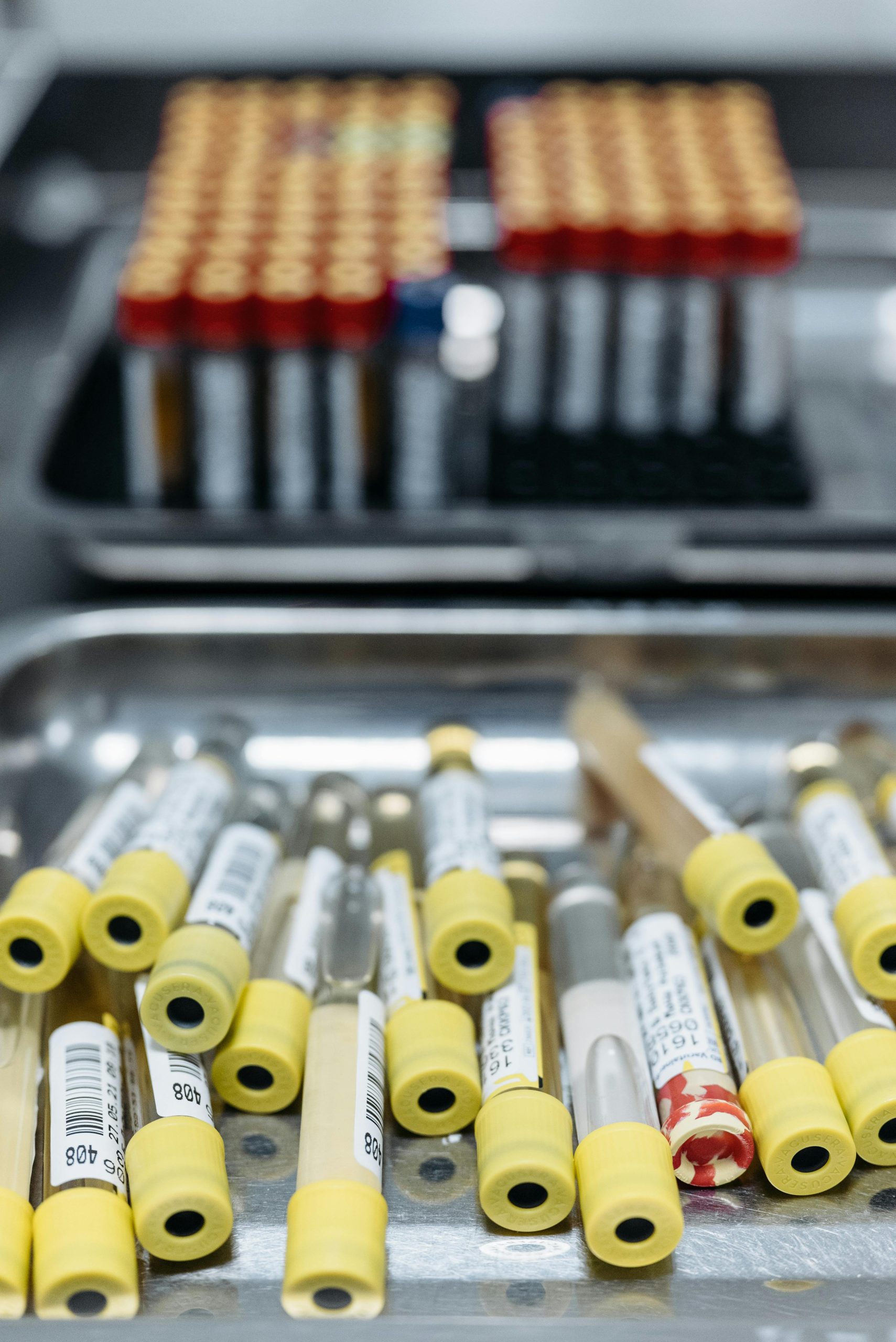Exames Laboratoriais para Diagnóstico da Dengue: Por Que São Indispensáveis?