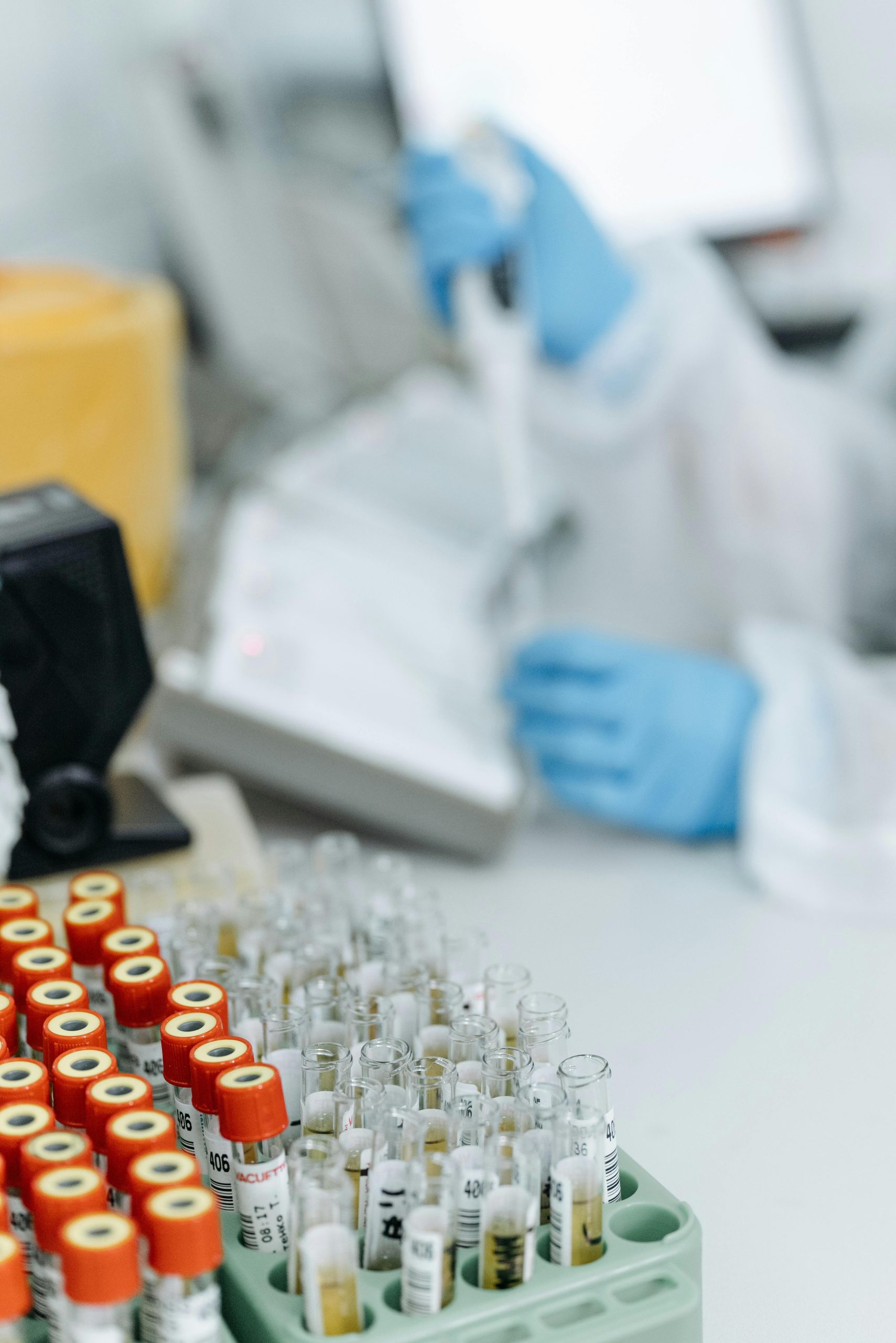 Quando Realizar Exames Laboratoriais para Diagnosticar a Dengue?