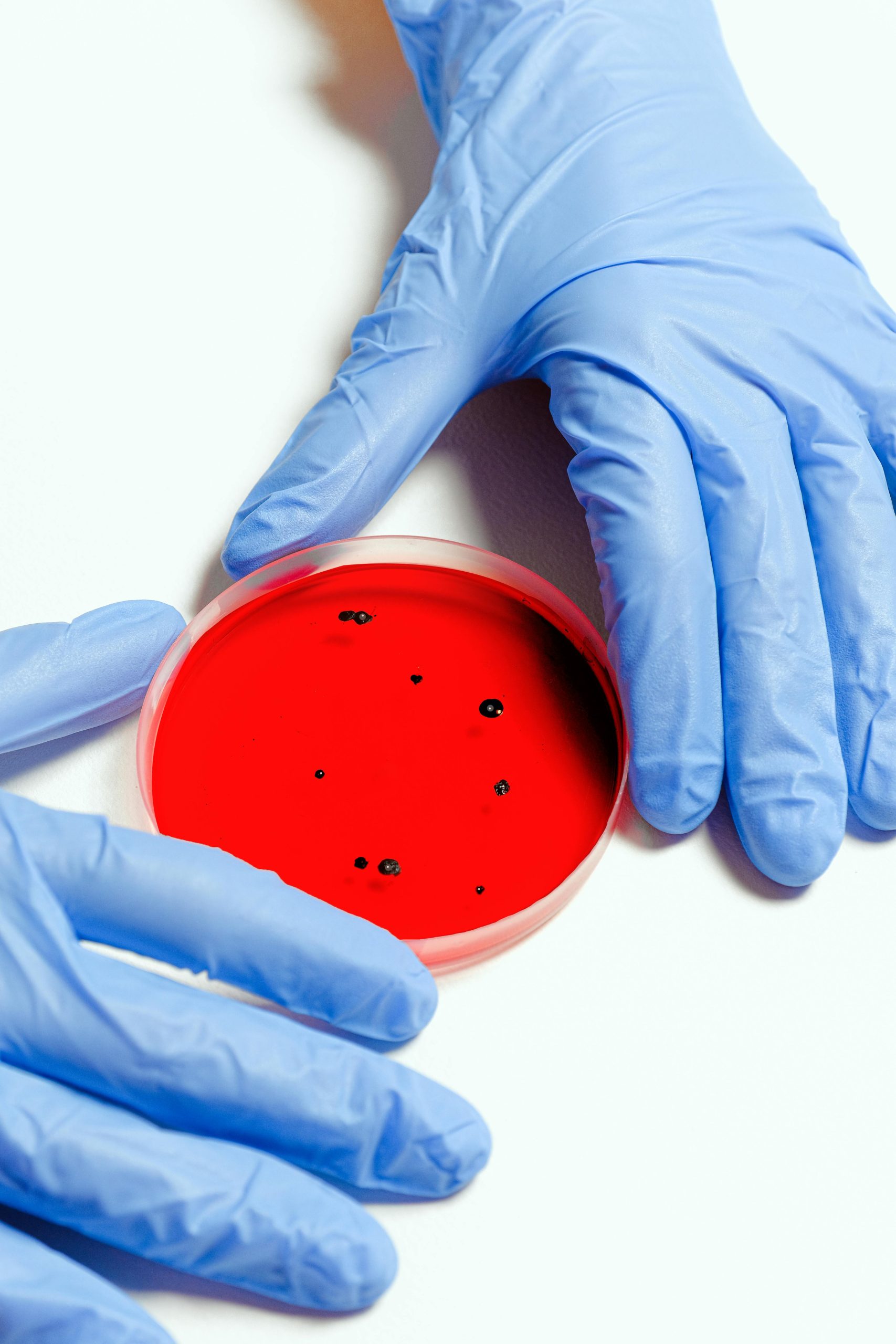 Influenza em 2025: A importância de realizar exames laboratoriais no início do ano