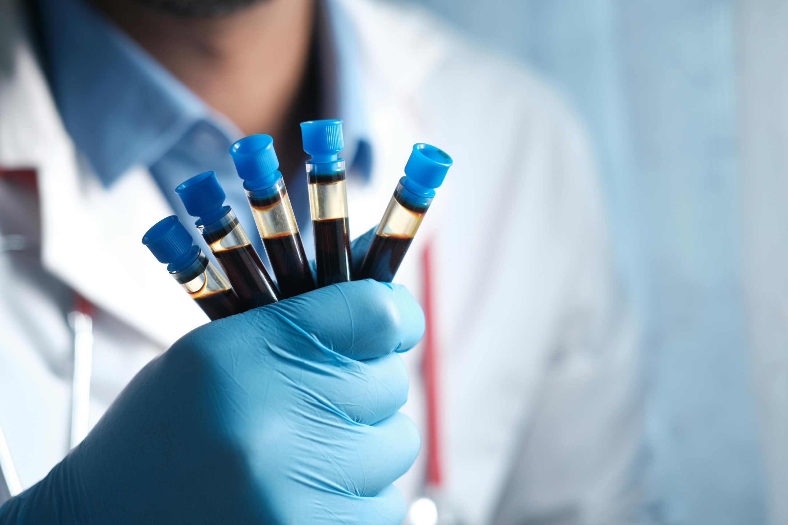 Prevenção e Diagnóstico: Como os Exames Laboratoriais Protegem Contra Dengue, COVID-19 e Influenza