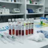 diagnóstico hormonal